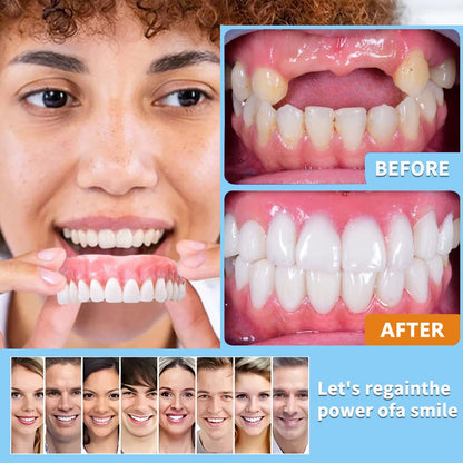 Premium Comfort-Fit Denture Set – Natural-Looking Smile, Easy At-Home Fit